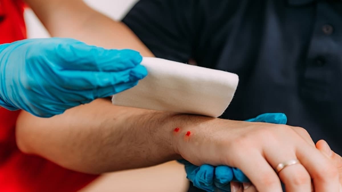 Yılan ısırıklarında yapılan 'ilk yardım' sanılan müdahale gerçekte hayati risk taşıyor