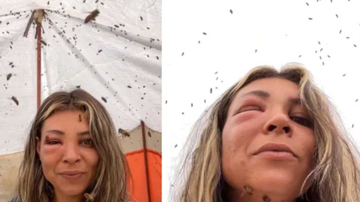 Arılarıyla yakınlaşmak isterken yüzü tanınmaz hale geldi