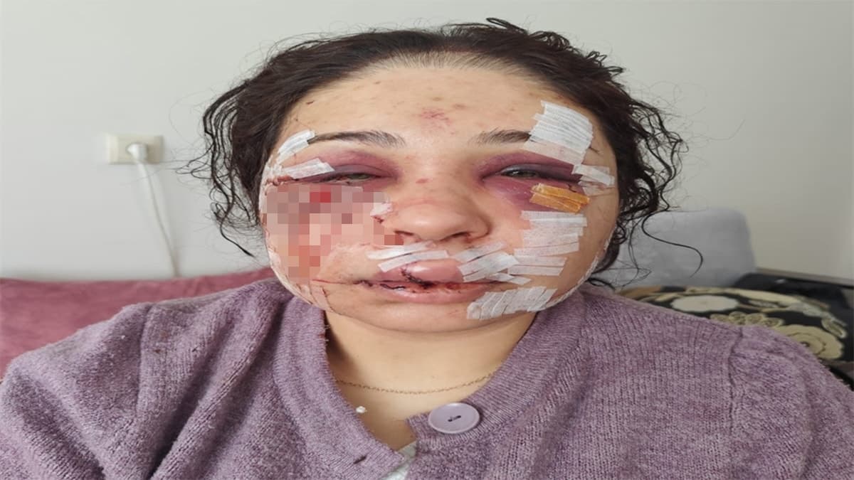 Boşanma aşamasındaki eşini darbeden polis memuru, savunmasının ardından serbest bırakıldı