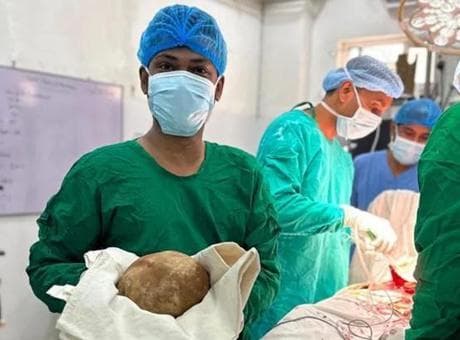 Sri Lanka'da tıp tarihine geçen ameliyat: Hastanın mesanesinden 3,1 kilogramlık taş çıkarıldı